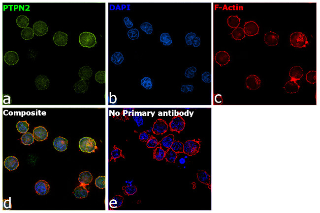 PTPN2 Antibody in Immunocytochemistry (ICC/IF)