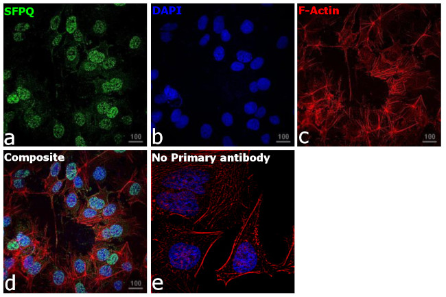 SFPQ Antibody in Immunocytochemistry (ICC/IF)