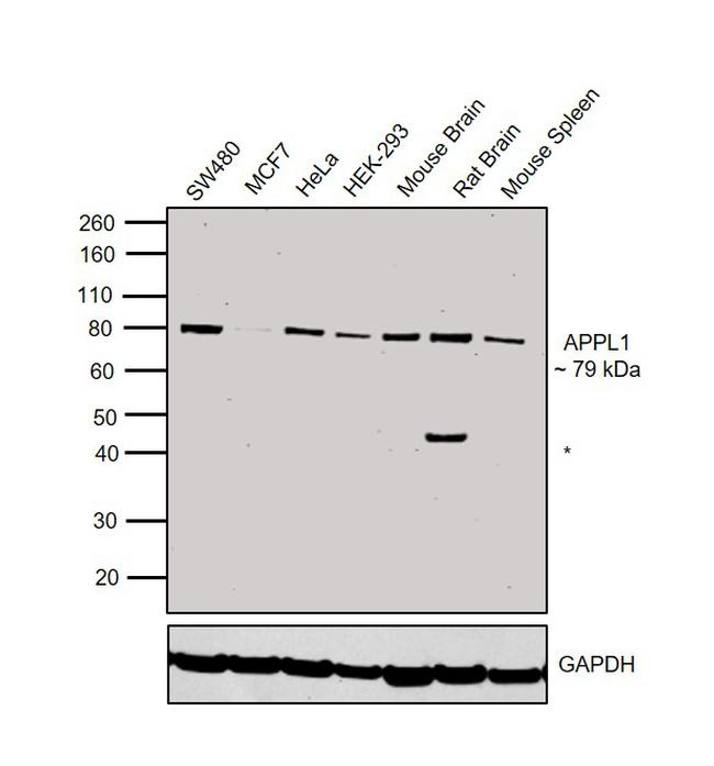 APPL1 Antibody in Western Blot (WB)