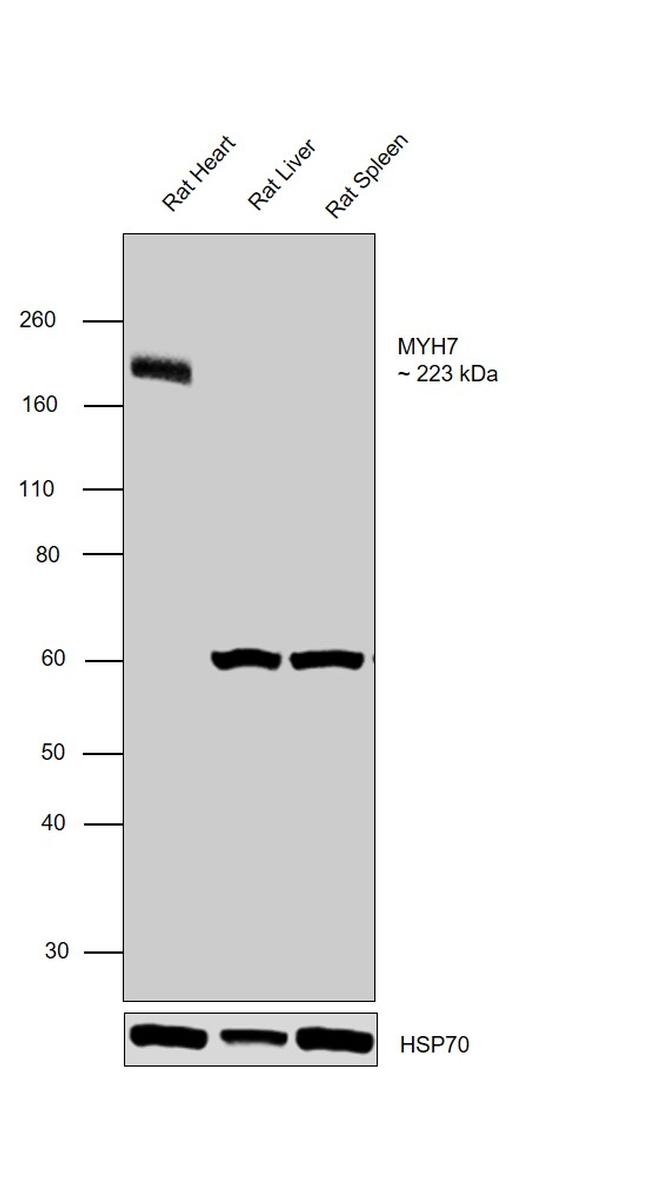 MYH7 Antibody in Western Blot (WB)