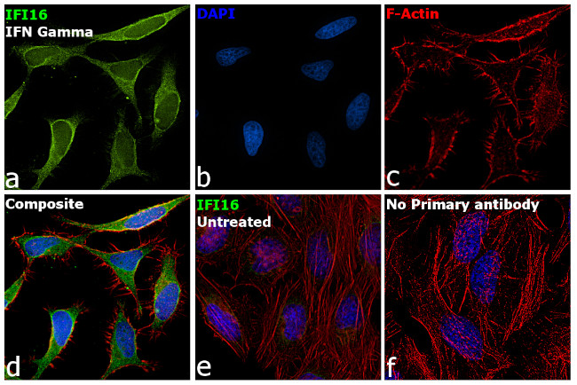 IFI16 Antibody in Immunocytochemistry (ICC/IF)