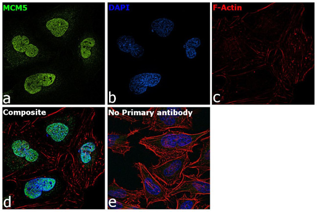 MCM5 Antibody in Immunocytochemistry (ICC/IF)