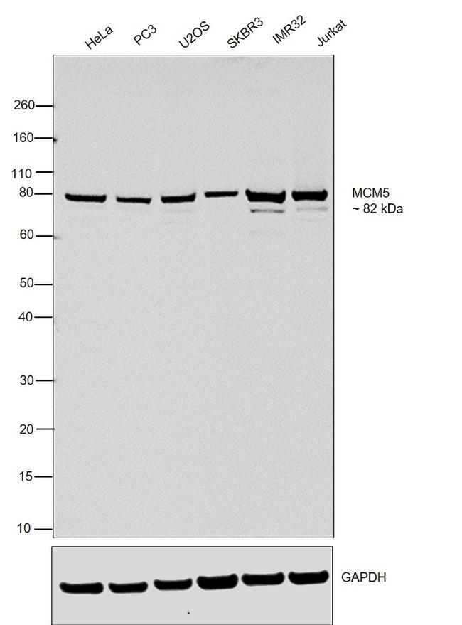 MCM5 Antibody in Western Blot (WB)