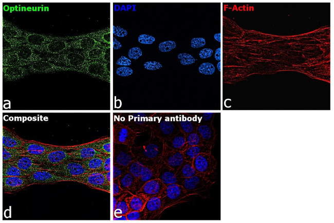 Optineurin Antibody in Immunocytochemistry (ICC/IF)