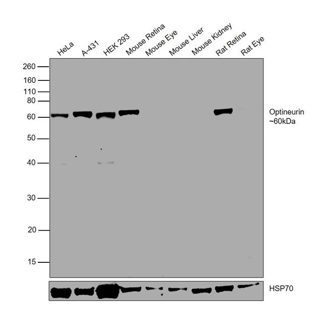 Optineurin Antibody in Western Blot (WB)