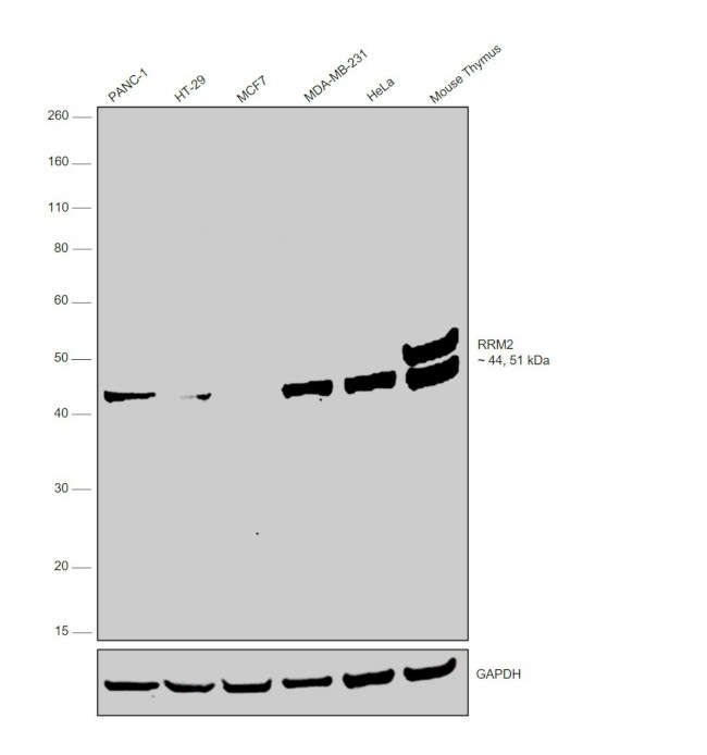 RRM2 Antibody