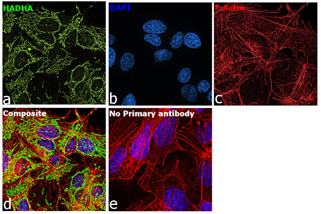 HADHA Antibody in Immunocytochemistry (ICC/IF)