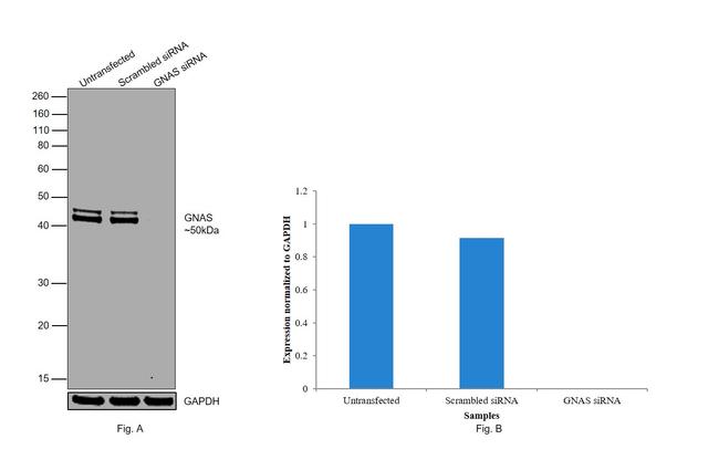 GNAS Antibody in Western Blot (WB)