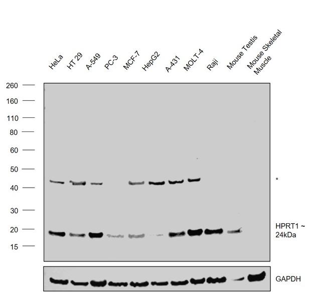 HPRT1 Antibody in Western Blot (WB)