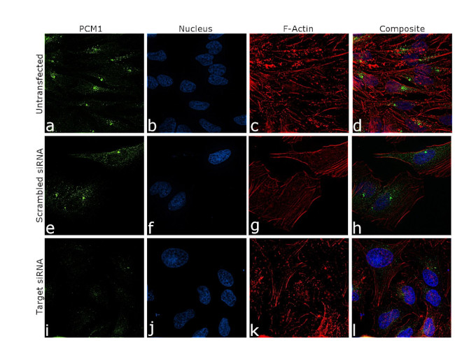 PCM1 Antibody in Immunocytochemistry (ICC/IF)