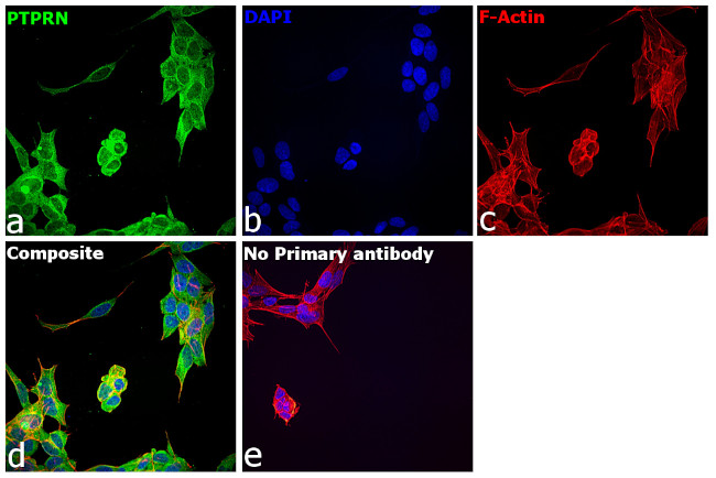 PTPRN Antibody in Immunocytochemistry (ICC/IF)