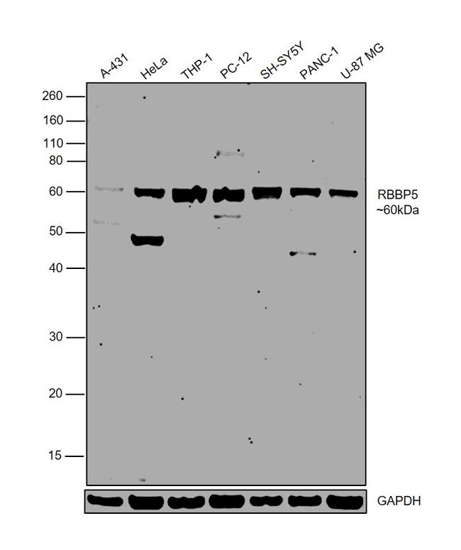 RBBP5 Antibody in Western Blot (WB)