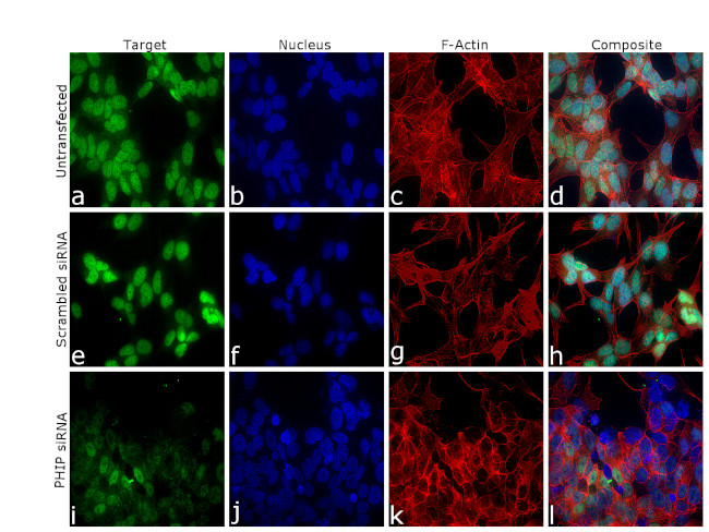 PHIP Antibody in Immunocytochemistry (ICC/IF)