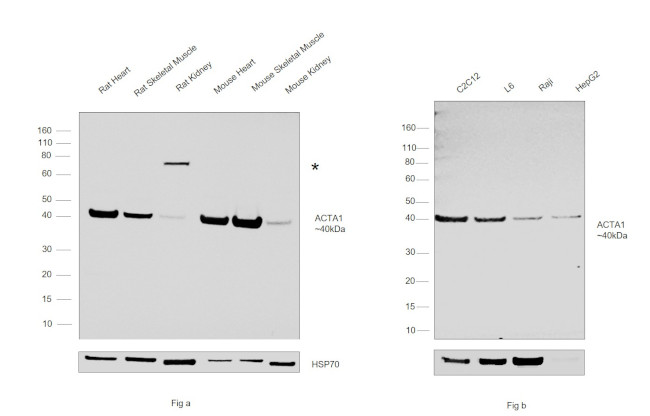 Skeletal Muscle Actin Antibody