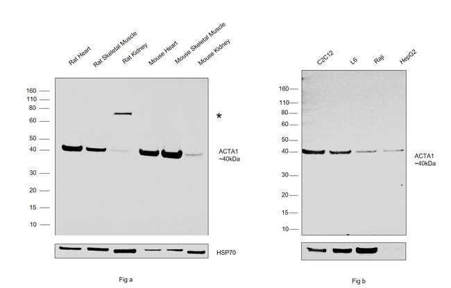 Skeletal Muscle Actin Antibody in Western Blot (WB)