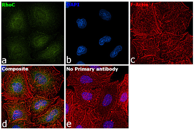 RhoC Antibody in Immunocytochemistry (ICC/IF)