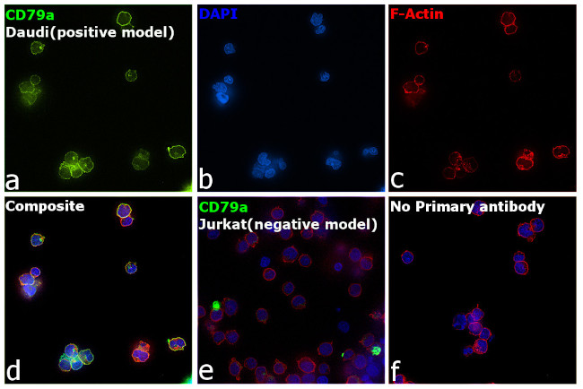 CD79a Antibody in Immunocytochemistry (ICC/IF)