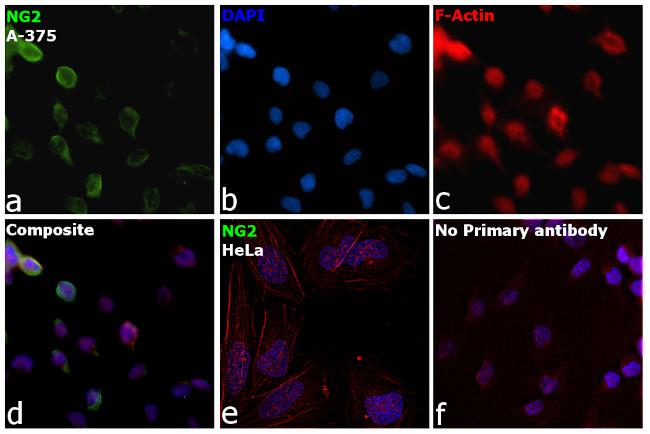 NG2 Antibody in Immunocytochemistry (ICC/IF)