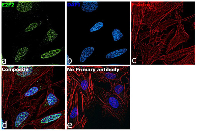 E2F2 Antibody in Immunocytochemistry (ICC/IF)