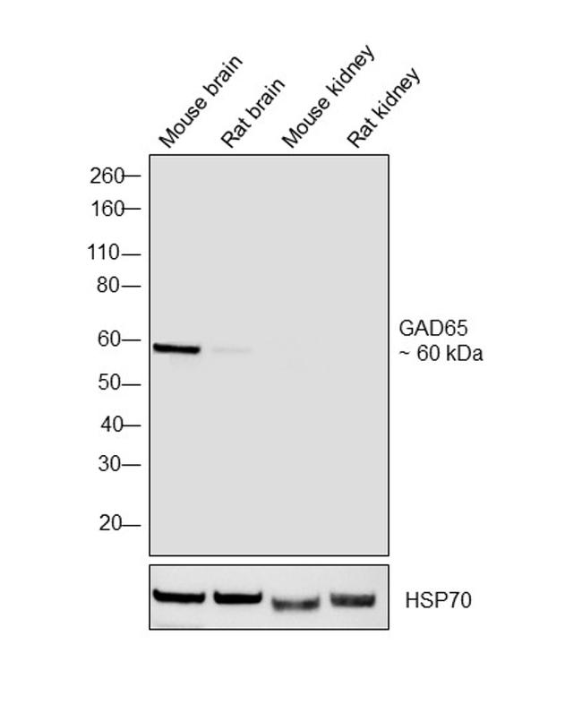 GAD65 Antibody in Western Blot (WB)