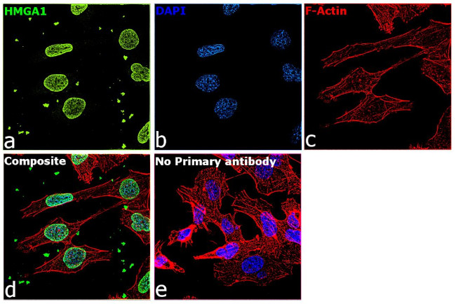 HMGA1 Antibody in Immunocytochemistry (ICC/IF)