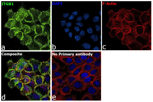 ITGB1 Antibody in Immunocytochemistry (ICC/IF)