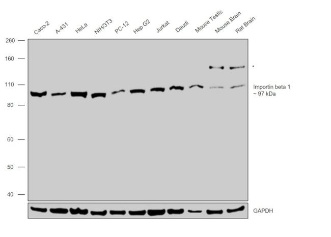 KPNB1 Antibody in Western Blot (WB)