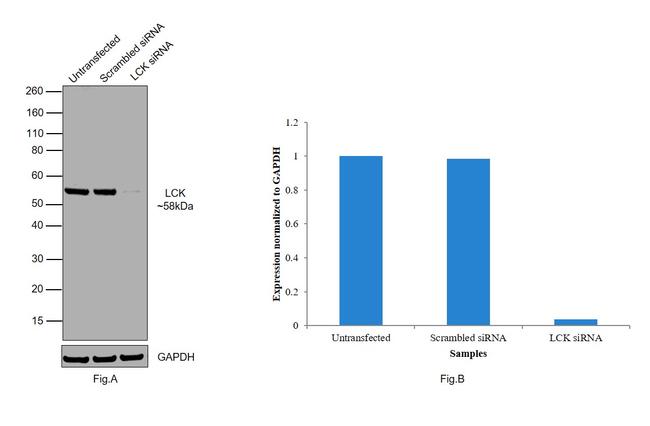 LCK Antibody in Western Blot (WB)