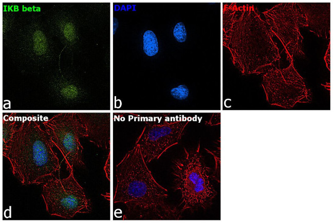 IkB beta Antibody in Immunocytochemistry (ICC/IF)