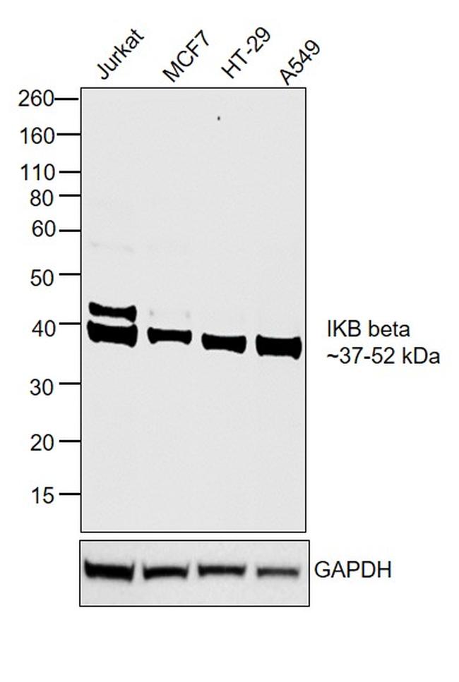 IkB beta Antibody in Western Blot (WB)