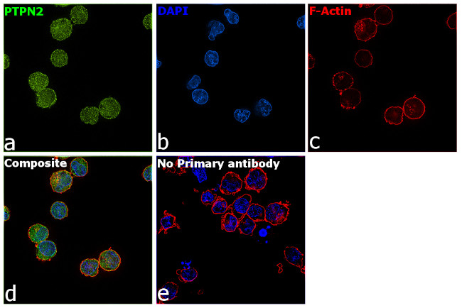 PTPN2 Antibody in Immunocytochemistry (ICC/IF)