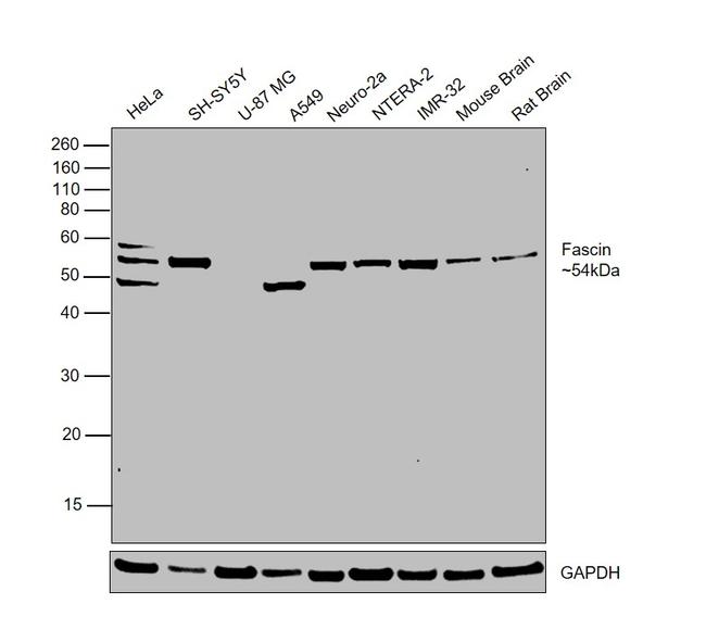 Fascin Antibody in Western Blot (WB)