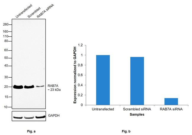 RAB7A Antibody in Western Blot (WB)