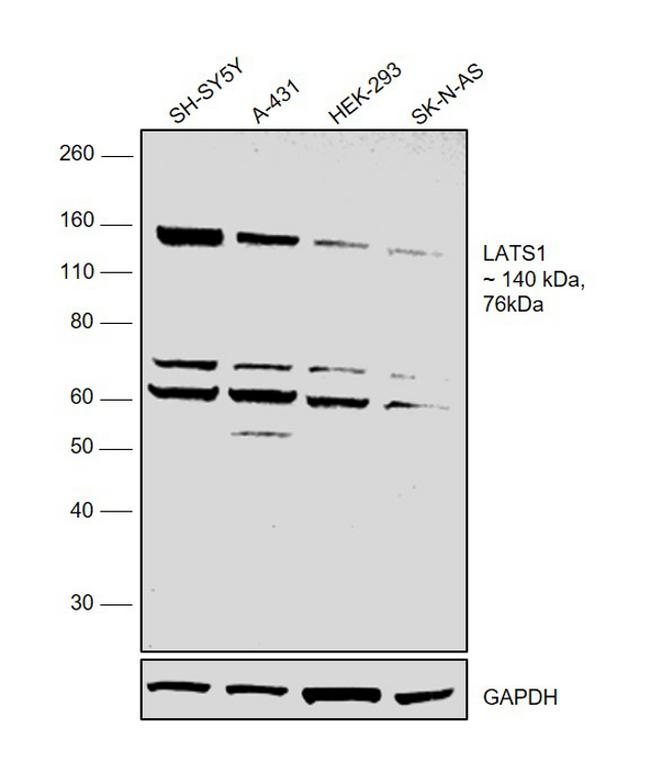 LATS1 Antibody in Western Blot (WB)