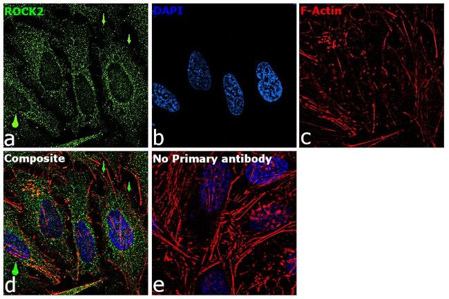 ROCK2 Antibody in Immunocytochemistry (ICC/IF)