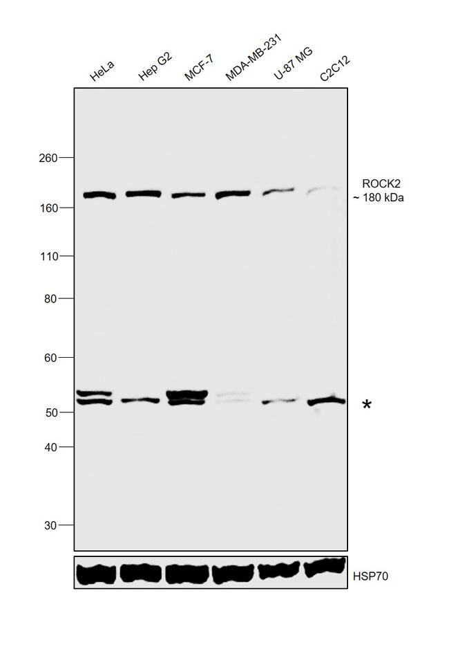 ROCK2 Antibody in Western Blot (WB)