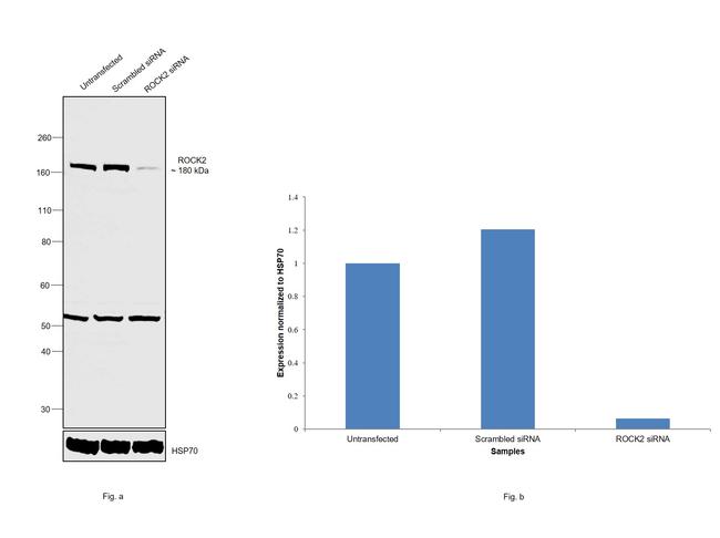 ROCK2 Antibody in Western Blot (WB)