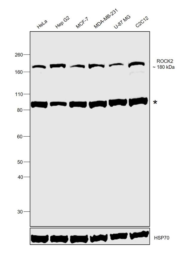 ROCK2 Antibody in Western Blot (WB)