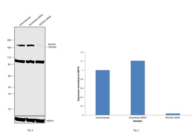 ROCK2 Antibody in Western Blot (WB)