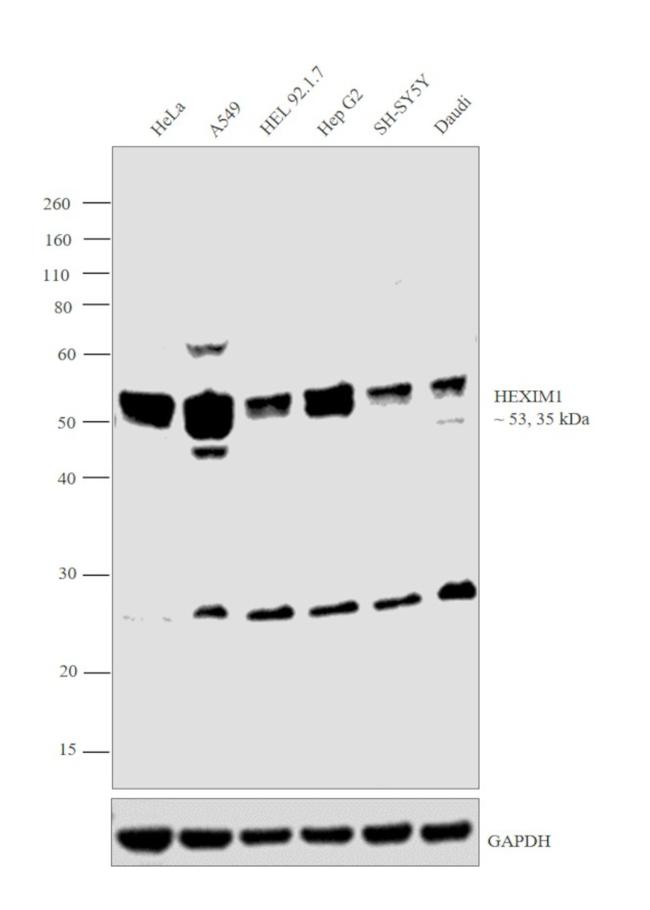 HEXIM1 Antibody in Western Blot (WB)