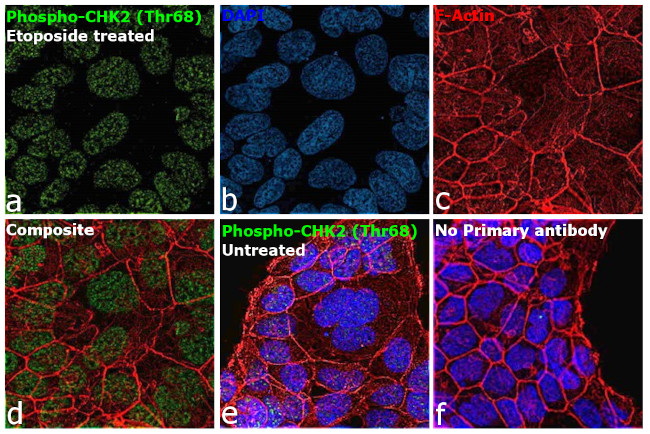 Phospho-CHK2 (Thr68) Antibody in Immunocytochemistry (ICC/IF)