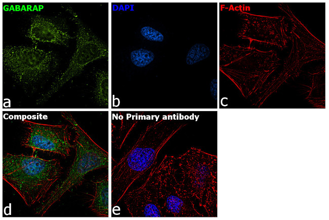 GABARAP Antibody in Immunocytochemistry (ICC/IF)