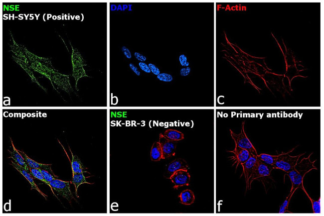 NSE Antibody