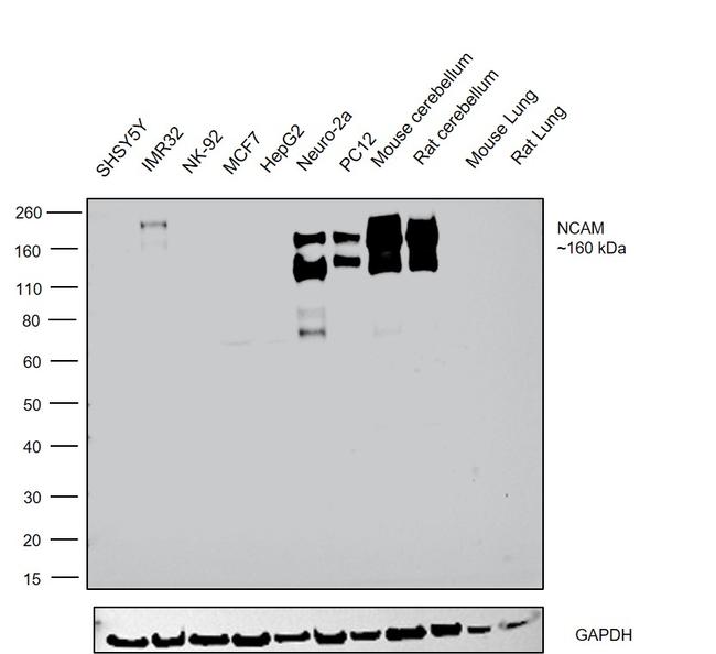 CD56 (NCAM) Antibody in Western Blot (WB)
