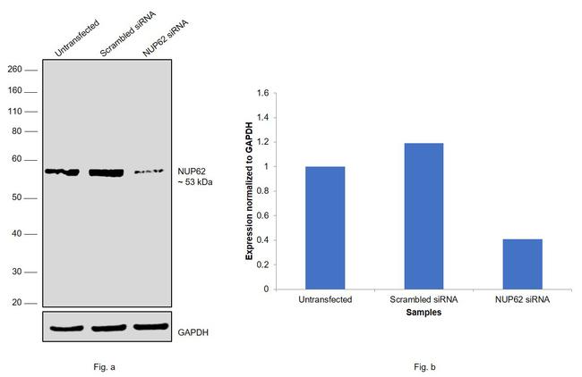 NUP62 Antibody in Western Blot (WB)