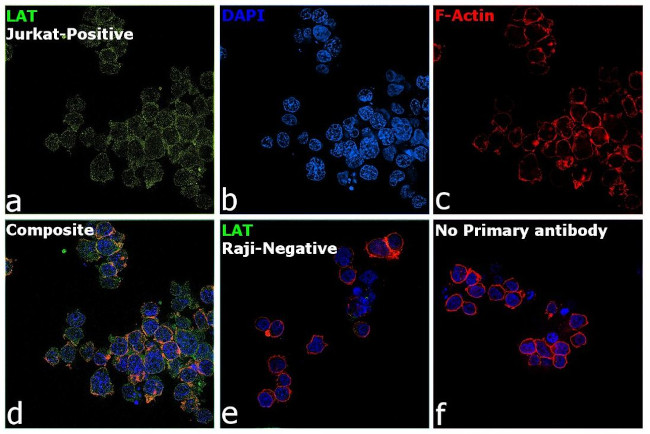 LAT Antibody