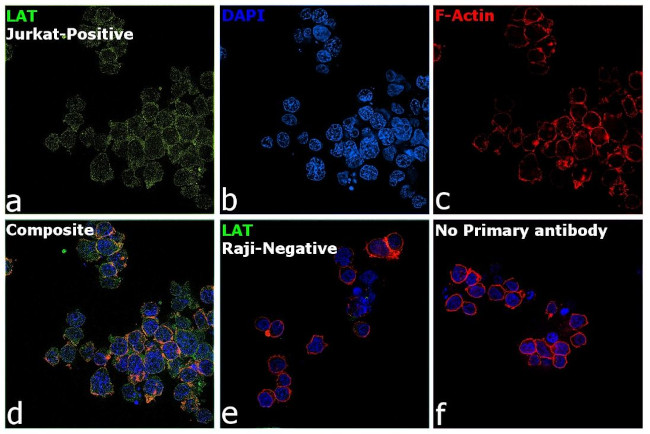 LAT Antibody in Immunocytochemistry (ICC/IF)