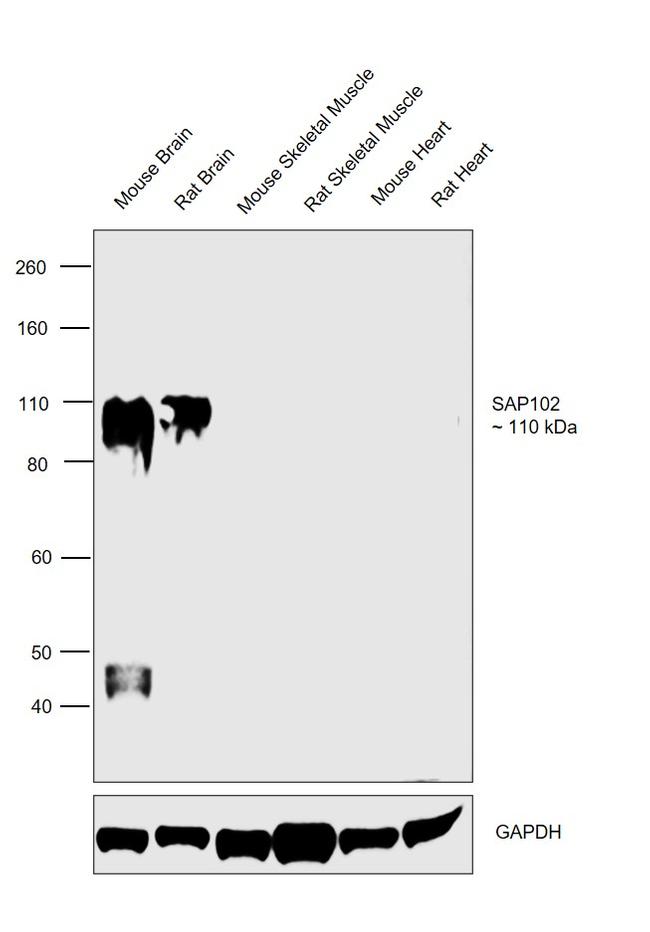 SAP102 Antibody in Western Blot (WB)