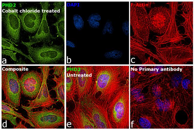 PHD2 Antibody