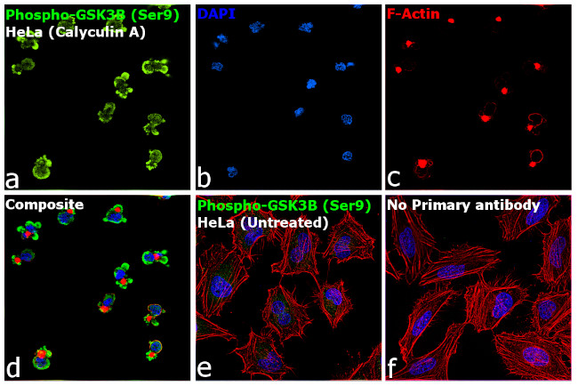 Phospho-GSK3B (Ser9) Antibody in Immunocytochemistry (ICC/IF)